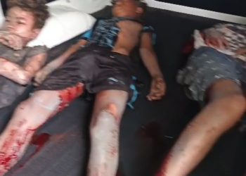 Viral! Tiga Bocah di Cilacap Terluka Parah Akibat Ledakan Mercon Rakitan