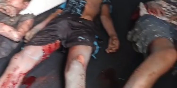 Viral! Tiga Bocah di Cilacap Terluka Parah Akibat Ledakan Mercon Rakitan