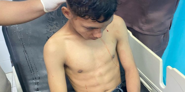 Atlit Tarung Derajat korban penculikan dan penganiayaan