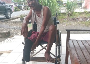 Derita Sagiman, Kaki Diamputasi, Hidup Terlunta, Hanya Ingin Kaki Palsu untuk ke Masjid