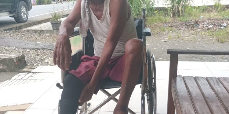 Derita Sagiman, Kaki Diamputasi, Hidup Terlunta, Hanya Ingin Kaki Palsu untuk ke Masjid