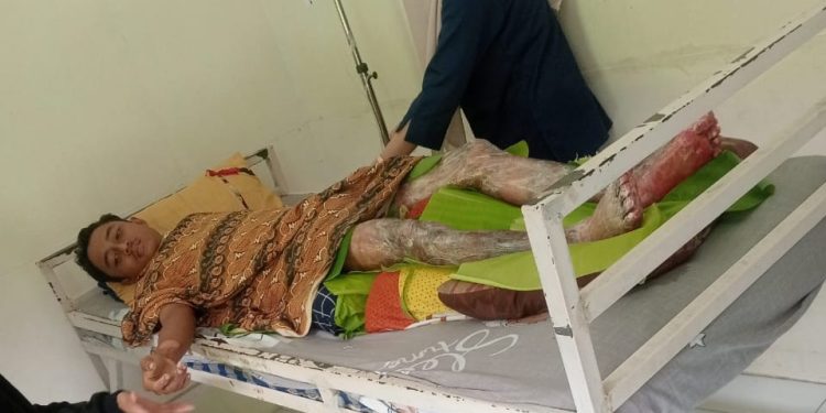 Buruh Desak Investigasi SMK3 PKS PT CCMO, Pekerja Muda “Masak” Ditangki Rebusan